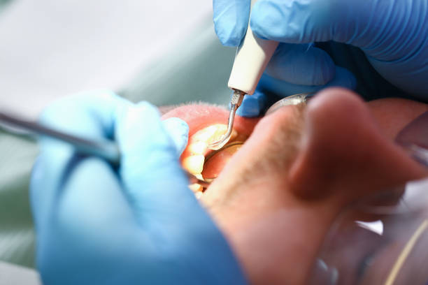 Best Broken or Chipped Tooth Repair in Alcoa, TN